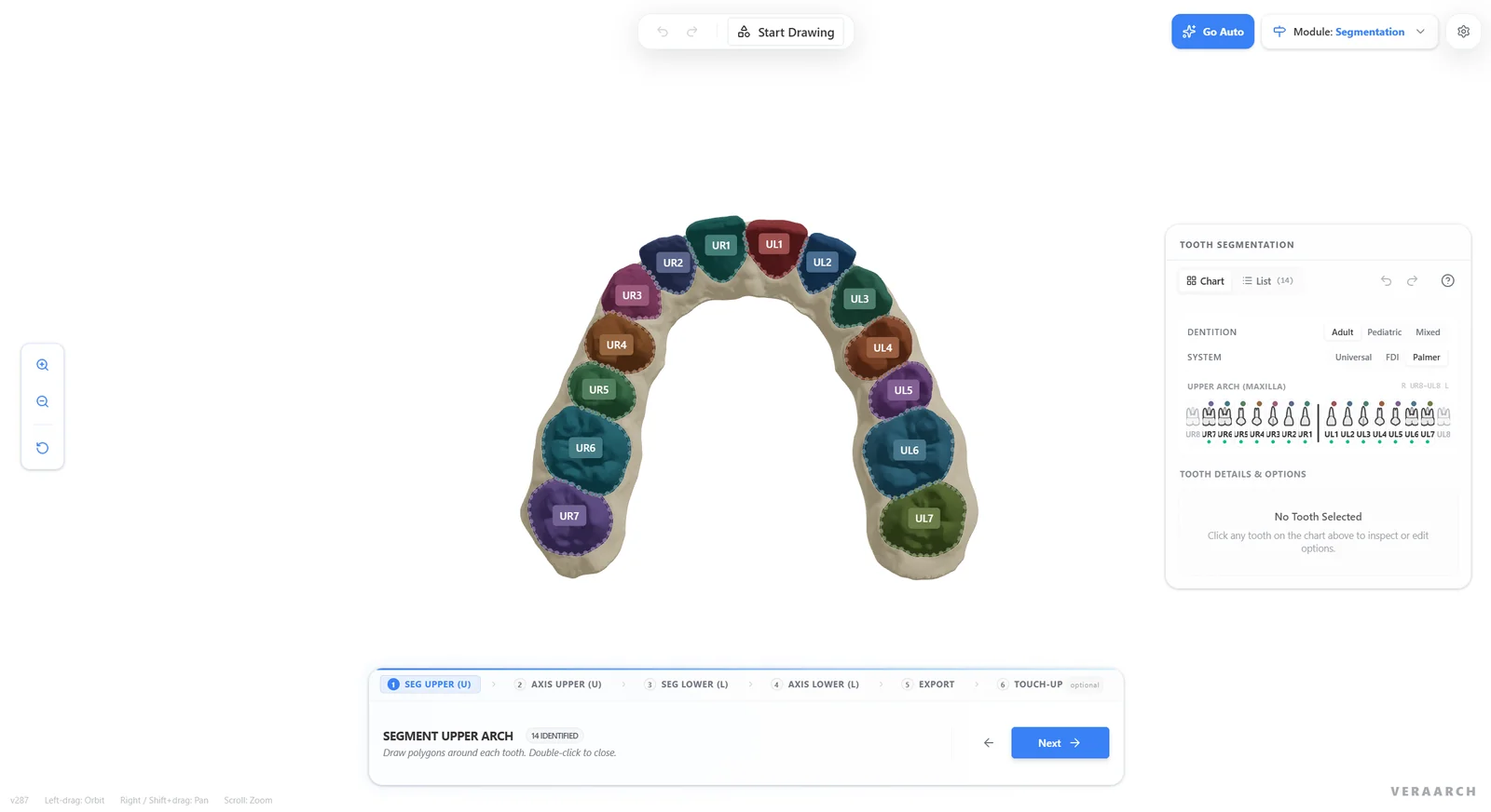 AI segmentation of an upper arch with every tooth outlined and numbered