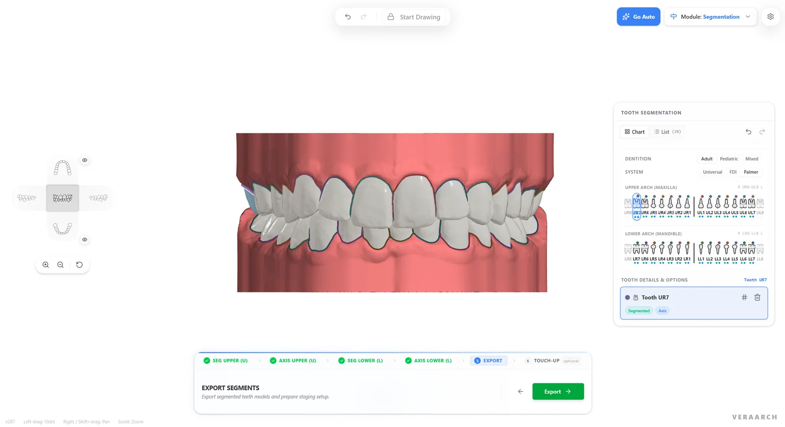 Both arches segmented with a full tooth chart