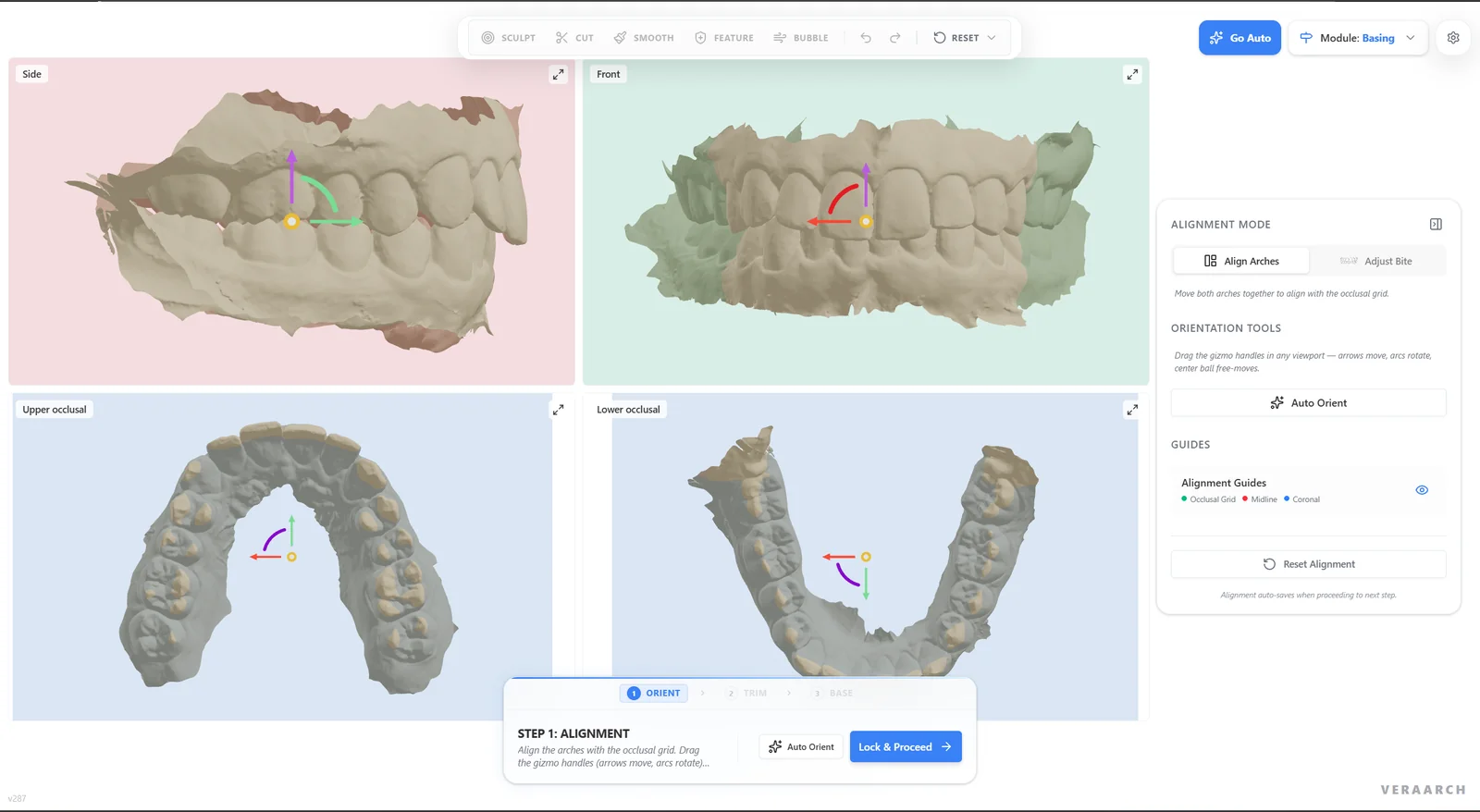 Auto Orient step with side, front and occlusal viewports