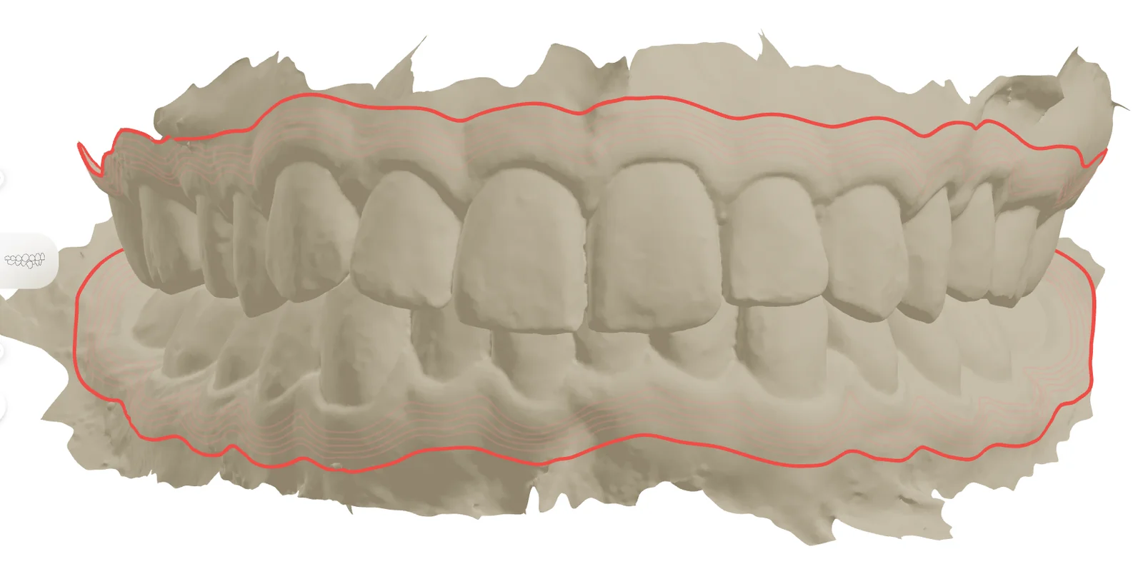 Automatic trim line previewed around both arches
