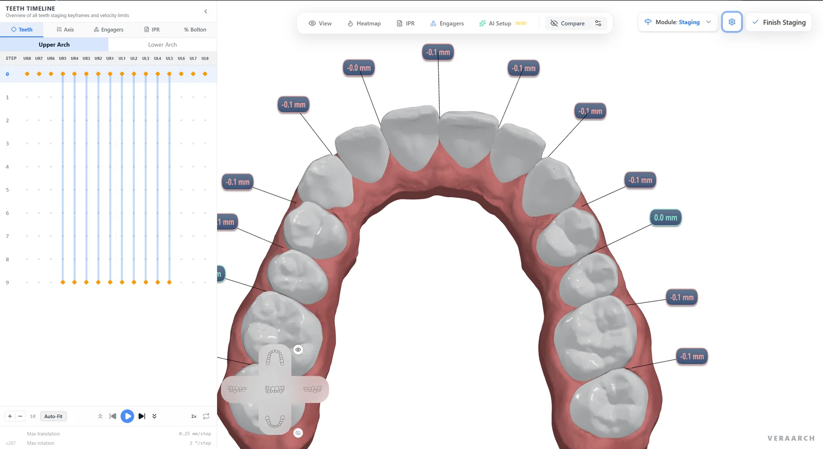 Automatic contact measurements labelled between each pair of teeth